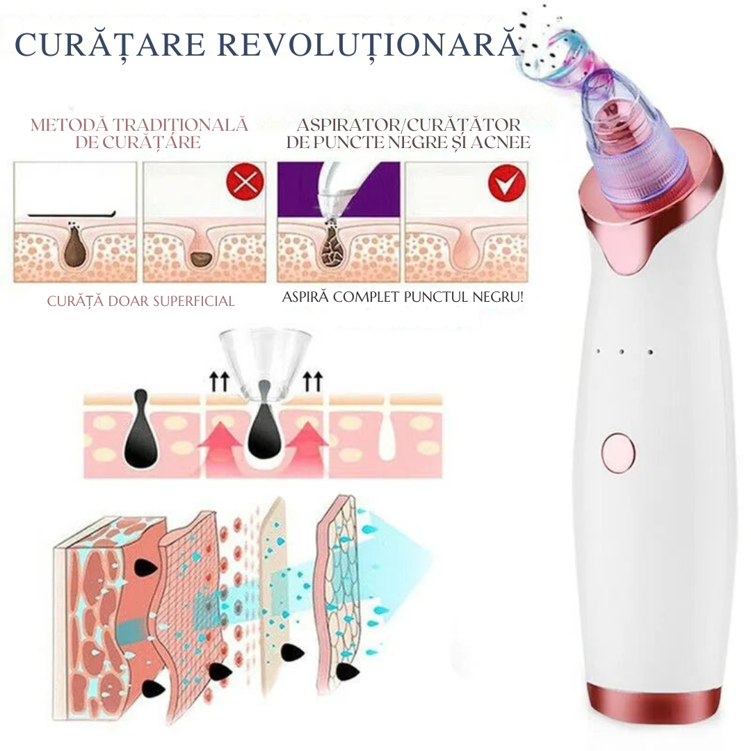 Extractor de acnee – Curățare Eficientă și Fără Durere