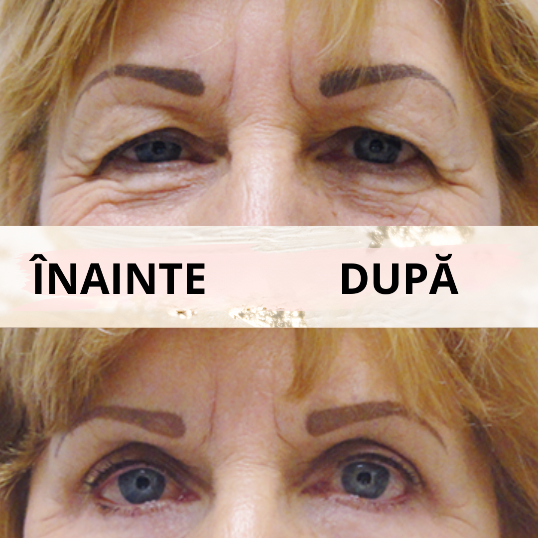 Eyelid PushUp 🤩 Privire Instantanee ✨ 120 Perechi! 😱